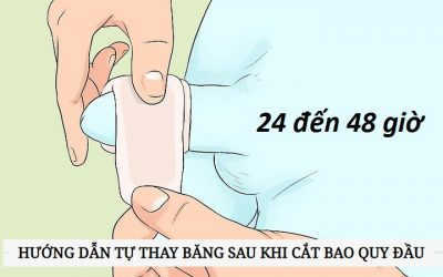 [ CHIA SẺ ] Cắt bao quy đầu bao lâu thì tháo băng? Khi tháo băng cần lưu ý những gì?