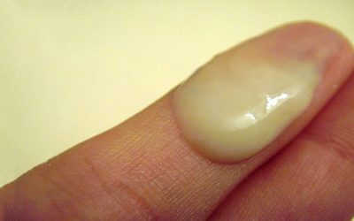 Tinh trùng màu vàng có phải mắc bệnh?