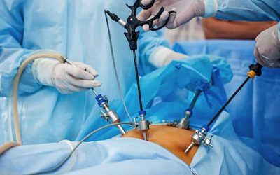 Mổ nội soi u nang buồng trứng kiêng ăn gì, nên ăn gì tốt?