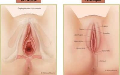 Kinh nghiệm thu nhỏ âm đạo tại bệnh viện phụ sản