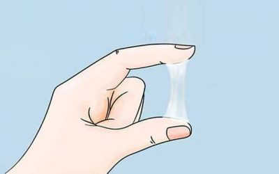 Vùng Kín Có Mảng Bám Màu Trắng Gây Ngứa Ngáy Là Bệnh Gì?