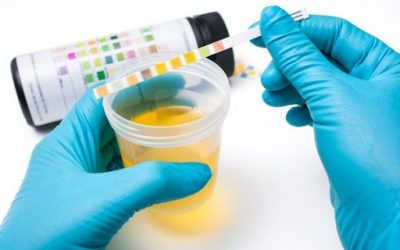 Nước tiểu màu vàng sáng khi mang thai là trai hay gái?