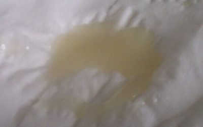 Cách nhận biết hình ảnh tinh trùng có màu gì là bình thường