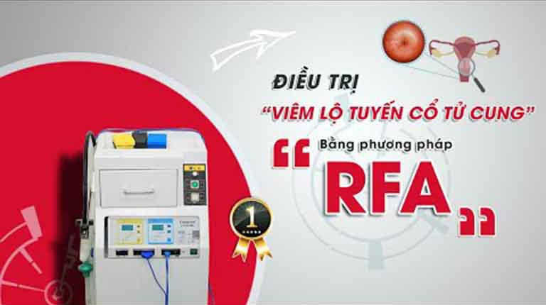 Công nghệ RFA