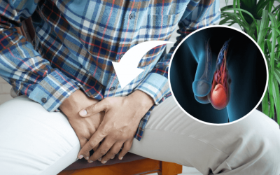 [Giải đáp thắc mắc] Giãn tĩnh mạch thừng tinh có nguy hiểm không?