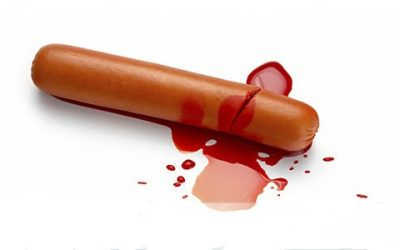 Dương vật chảy máu có làm sao không? Cảnh báo mắc bệnh nguy hiểm