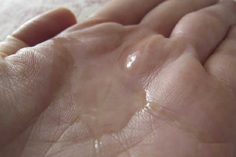 [ BẬT MÍ ] Cách nhận biết tinh trùng loãng đơn giản bằng mắt thường