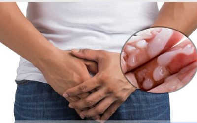 Tinh trùng đặc sệt dấu hiệu nguy hiểm không thể xem nhẹ [Tìm hiểu ngay]