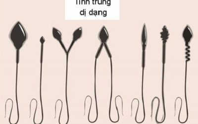 Tinh trùng dị dạng có thụ thai được không, cải thiện như thế nào?