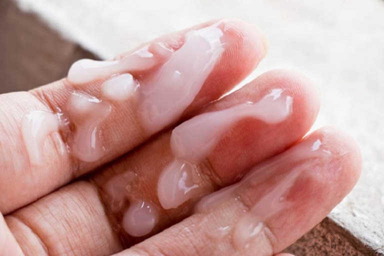 Tinh trùng vón cục như thạch: nguyên nhân, dấu hiệu và cách chữa