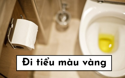 Hiện tượng đi tiểu màu vàng và những điều bạn cần biết