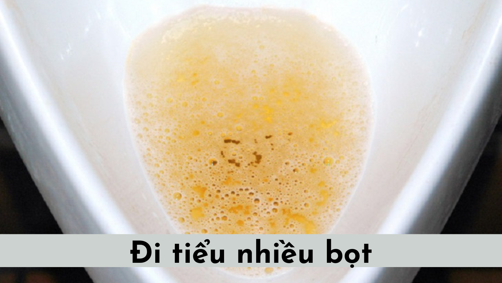 Vì sao đi tiểu nhiều bọt? Dấu hiệu này cảnh báo tình trạng gì?