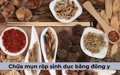 Có những cách nào chữa mụn rộp sinh dục bằng Đông y?