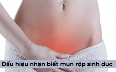 Bật mí những dấu hiệu nhận biết mụn rộp sinh dục