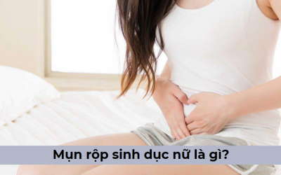 Tìm hiểu về mụn rộp sinh dục nữ là gì? – Chuyên gia giải đáp