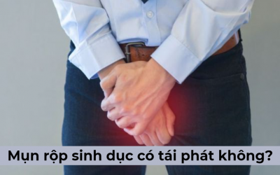 Chuyên gia tư vấn: Mụn rộp sinh dục có tái phát không?