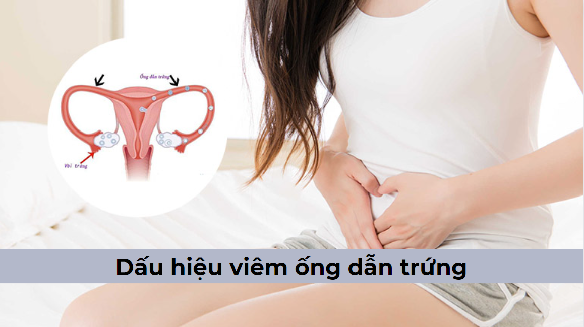 Những dấu hiệu viêm ống dẫn trứng mà chị em chớ nên chủ quan