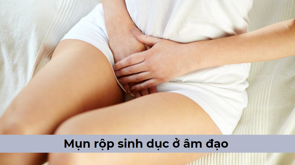 Mụn rộp sinh dục ở âm đạo – những vấn đề chị em cần quan tâm