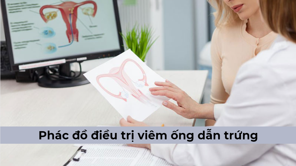 [Tìm hiểu] Phác đồ điều trị viêm ống dẫn trứng Bộ Y tế mới nhất