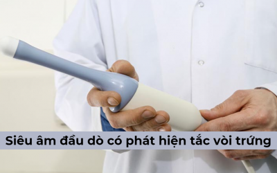 [Giải đáp] Siêu âm đầu dò có phát hiện tắc vòi trứng?
