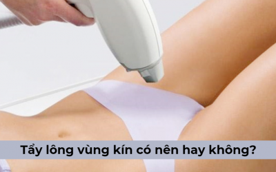 Tẩy lông vùng kín có nên hay không? Cách thực hiện nào an toàn?
