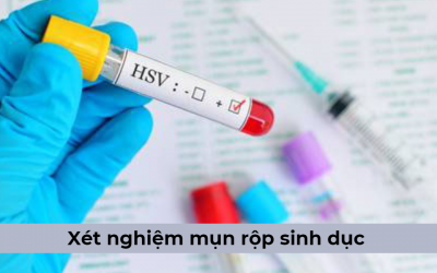 Lúc nào nên thực hiện xét nghiệm mụn rộp sinh dục?