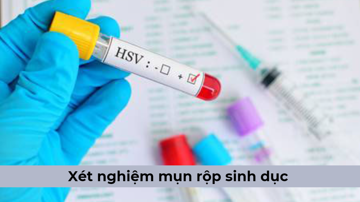 Lúc nào nên thực hiện xét nghiệm mụn rộp sinh dục?