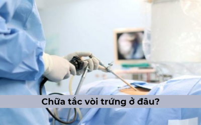 Tìm hiểu nên chữa tắc vòi trứng ở đâu tốt tại Hà Nội?