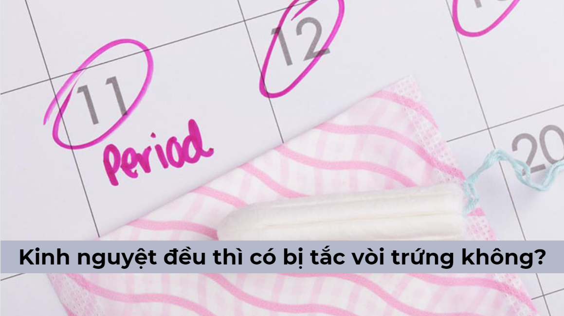 Kinh nguyệt đều thì có bị tắc vòi trứng không và những điều bạn nên biết