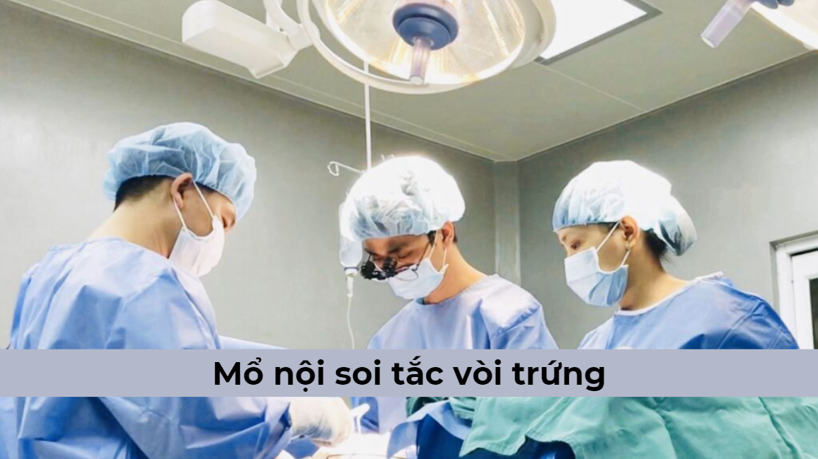 Những thông tin cần biết về mổ nội soi tắc vòi trứng ở nữ giới