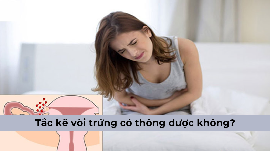 Góc giải đáp: Tắc kẽ vòi trứng có thông được không?