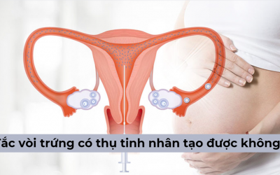 Bị tắc vòi trứng có thụ tinh nhân tạo được không? [Chuyên gia giải đáp]
