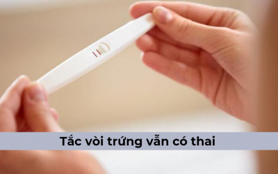 Tắc vòi trứng vẫn có thai và những điều bạn nên biết