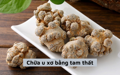 [Tổng hợp ] Bài thuốc chữa u xơ bằng tam thất, lưu ý để sử dụng hiệu quả