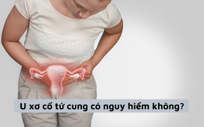 U xơ cổ tử cung có nguy hiểm không và cách chữa hiệu quả