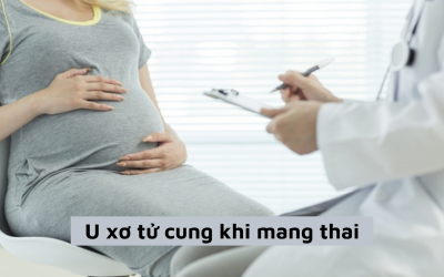 U xơ tử cung khi mang thai có ảnh hưởng tới thai nhi?