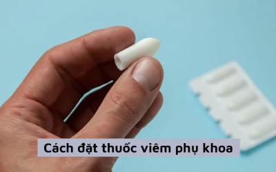 Tìm hiểu cách đặt thuốc viêm phụ khoa chuẩn y tế