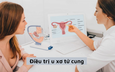 Hé lộ cách điều trị u xơ tử cung ở nữ giới hiệu quả nhất