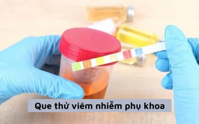Que thử viêm nhiễm phụ khoa là gì? Cách dùng và những lưu ý khi dùng