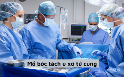 Mổ bóc tách u xơ tử cung có cần thiết không, khi nào phải tiến hành mổ?