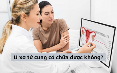 U xơ tử cung có chữa được không và những thông tin bạn cần biết