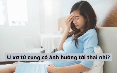 U xơ tử cung có ảnh hưởng tới thai nhi hay không, nên làm gì khi bị bệnh?