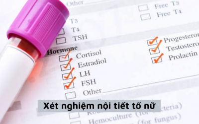 [Giải đáp] Nên xét nghiệm nội tiết tố nữ vào ngày nào là hợp lý nhất?