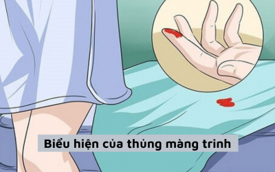 Biểu hiện của thủng màng trinh – Nhìn phát biết ngay