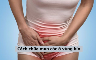 [Giải đáp thắc mắc] Cách chữa mụn cóc ở vùng kín an toàn, hiệu quả