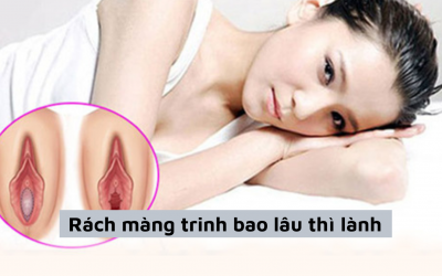 Rách màng trinh bao lâu thì lành? Địa chỉ vá màng trinh an toàn