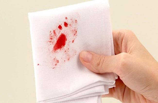 Phụ nữ bị rách màng trinh chảy máu màu gì?