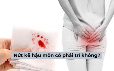 [Bác sĩ tư vấn] Nứt kẽ hậu môn có phải trĩ không?