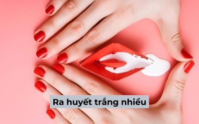 Ra huyết trắng nhiều: Nguyên nhân và cách phòng tránh hiệu quả
