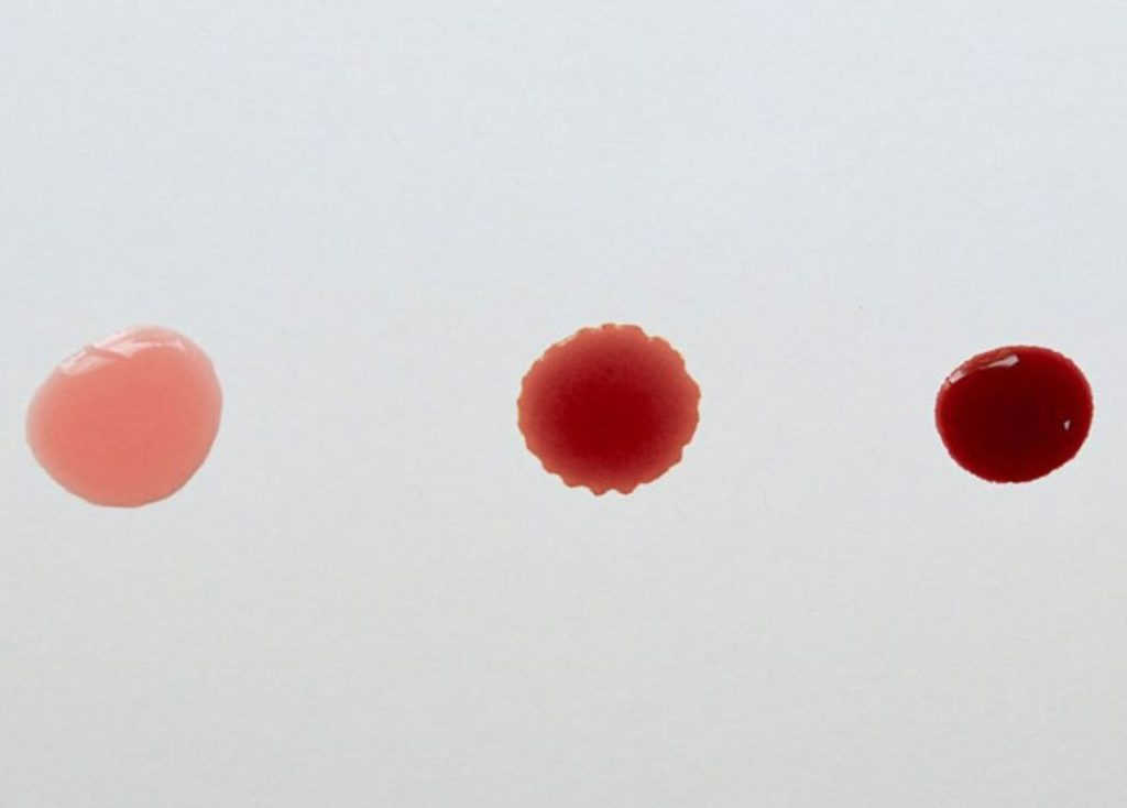 Phân biệt máu báo thai với các hiện tượng xuất huyết vùng kín khác